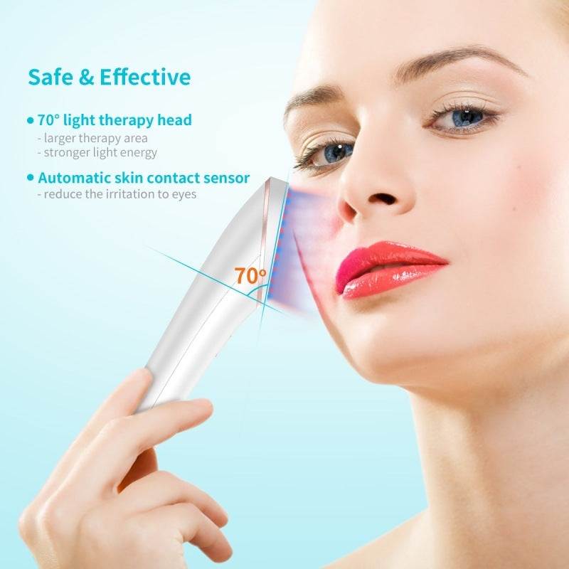 LED Light Acne Therapy