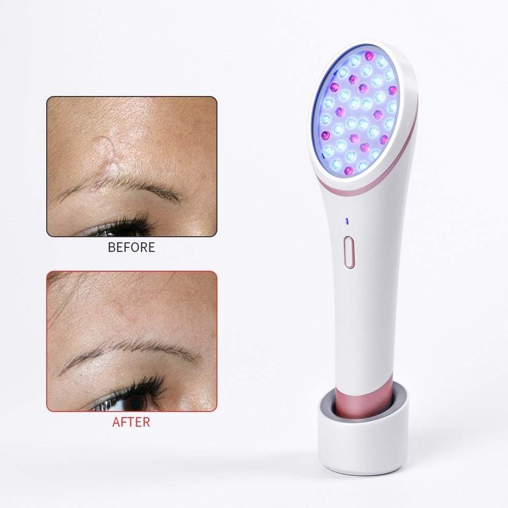 LED Light Acne Therapy