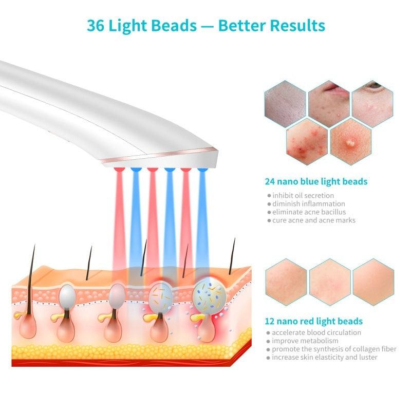 LED Light Acne Therapy